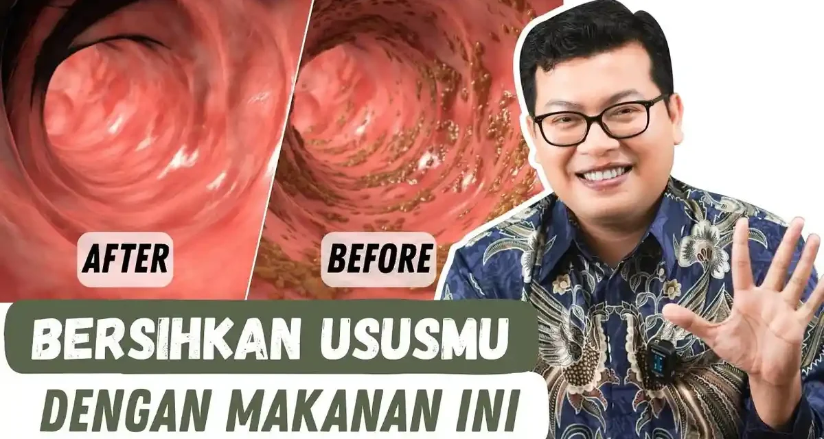 Usus Sehat Di Mulai Dari Makanan Ini, Jangan Salah Pilih!