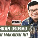 Usus Sehat Di Mulai Dari Makanan Ini, Jangan Salah Pilih!